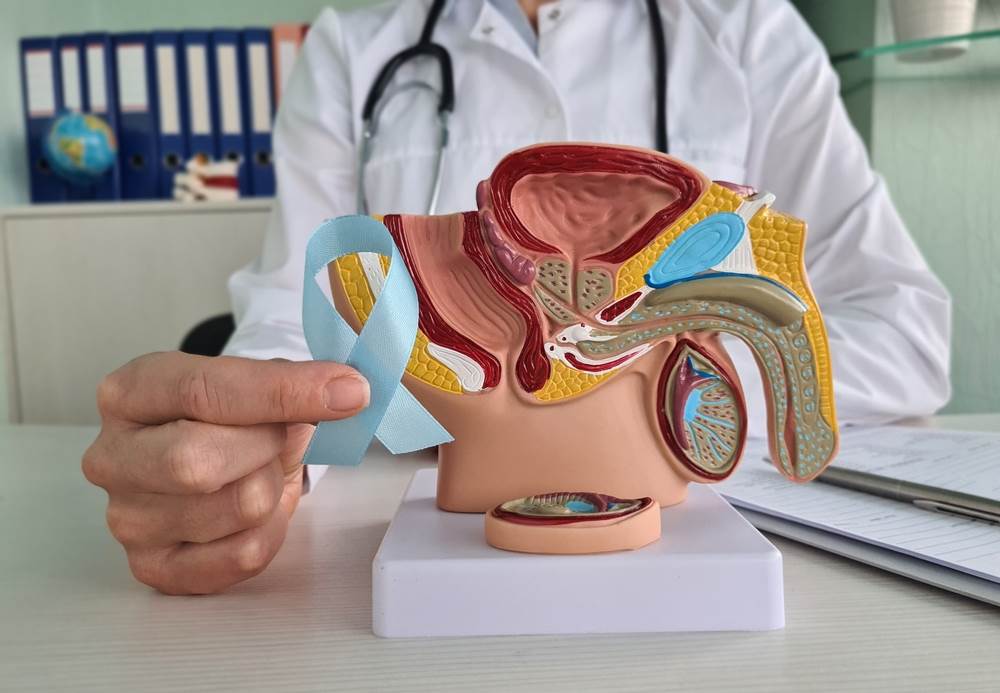 7 najčešćih simptoma raka testisa: U najvećem riziku su mlađi muškarci ...