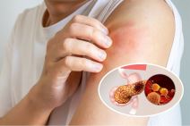 ženska osoba u ebloj majci češe levo rame / rak pankreasa