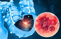 grafički prikaz raka debelog creva da izdvojenim detaljem u crvenoj boji