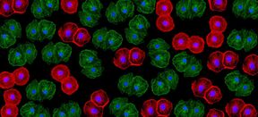Xenotransplantation