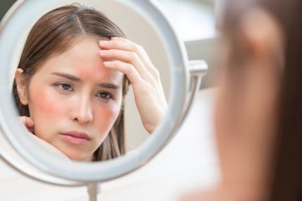 devojka sa crvenilon na obrazima i čelu gleda se u okruglom ogledalu