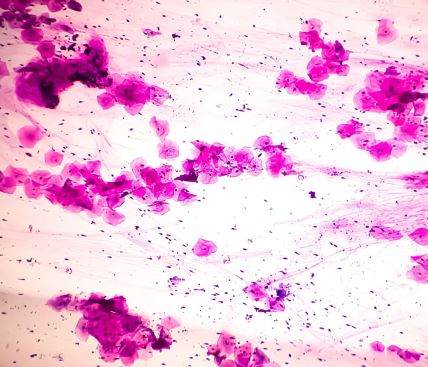 HPV ispod mikroskopa