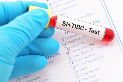 medicinski radnik u plavoim rukavicama drži epruvetu sa uzorkom krvi na kojoj piše SI + TIBC test