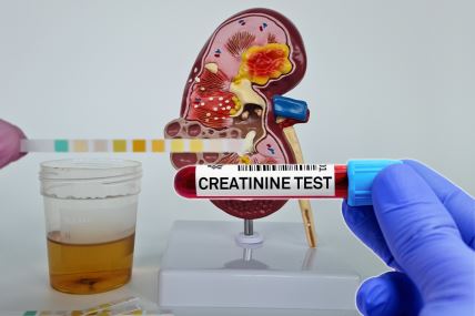 kreatinin, analiza, bubrezi