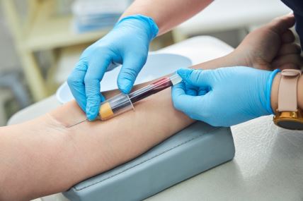 krupan plan ženske ruke naslonjene na jastuće dok medicinski radnik uz pomoć igle i epruvete uzima uzorak krvi