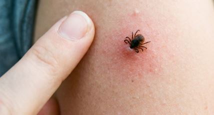 Krpelji i lajmska bolest