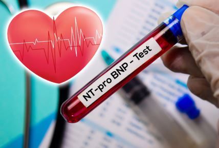 NT-proBNP test/srčana slabost