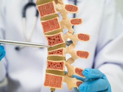 Osteoporoza