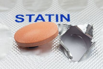 Statini