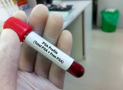 Rak prostate