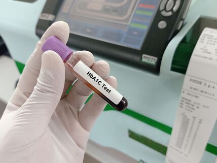 Hemoglobin A1c