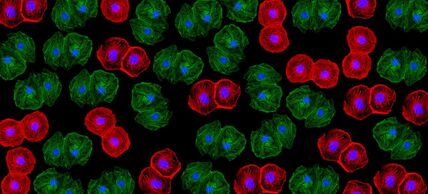 Xenotransplantation