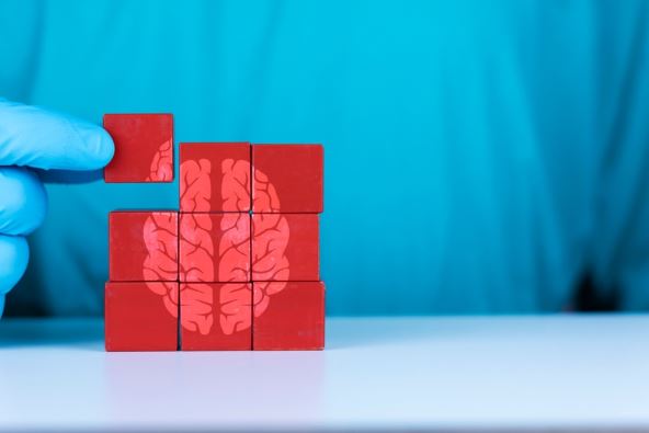 model mozga kome nedoste jedan deo, koncept alchajmerova bolest