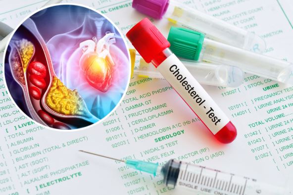 Hologramski prikaz srca i arterije zapušene holesterolom/krvni test holesterol