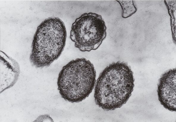 mikroskopski prikaz vibrio bakterije