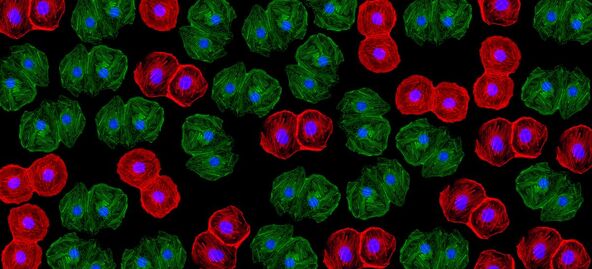 Xenotransplantation
